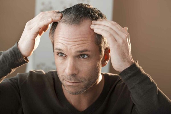 hair loss men