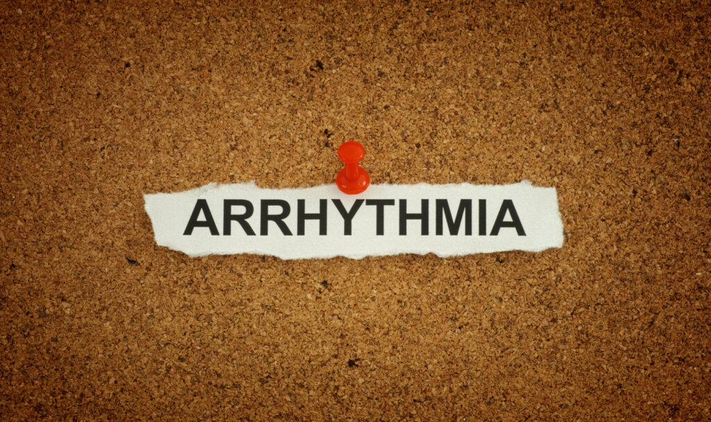 A paper note with the word Arrhythmia on it pinned to a cork board.
