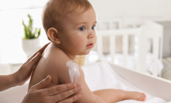 Νεαρή μητέρα βάζει κρέμα για ατοπική δερματίτιδα στο ευαίσθητο δέρμα του βρέφους της